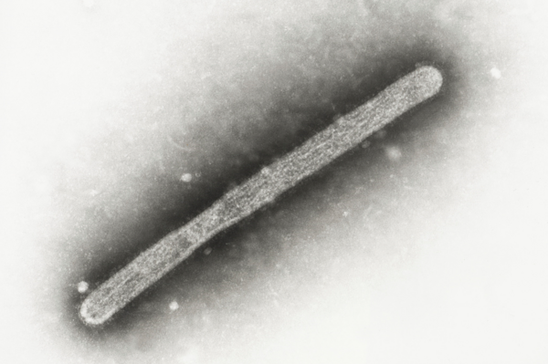 Michigan Farmworker Diagnosed With Bird Flu