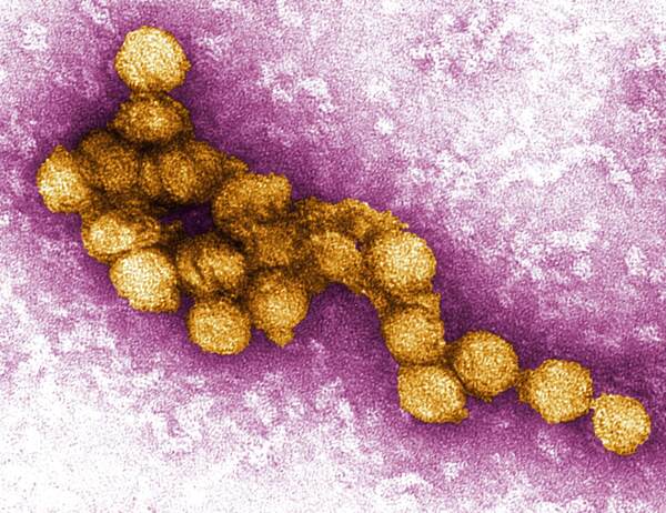 West MI County Confirms State's First West Nile Virus-Related Death of 2025