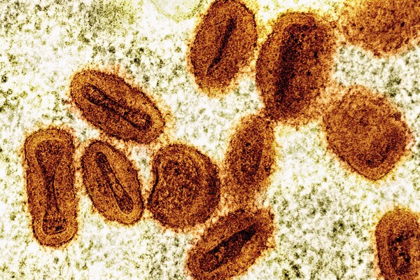 Two Scientists Charged with Bringing Deactivated Mpox Virus Into Detroit Metro, Lying to Authorities